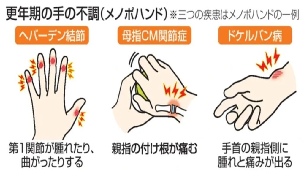 メノポハンド