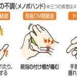 メノポハンド